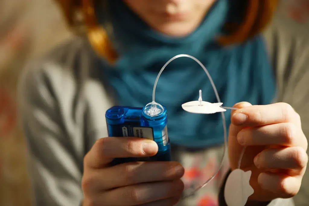 A young girl suffering from diabetes type 1, squeezes air bubbles out of her catheter.