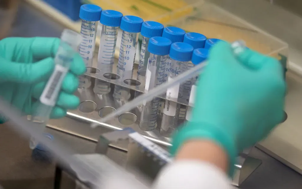  A staff member of the Baden-Württemberg State Health Authority is pipetting corona samples during an experiment.
