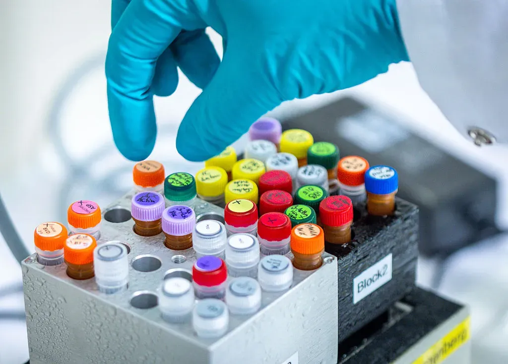 Various substances are placed on cooling blocks in the PCR laboratory of the State Office for Agriculture, Food Safety and Fisheries.