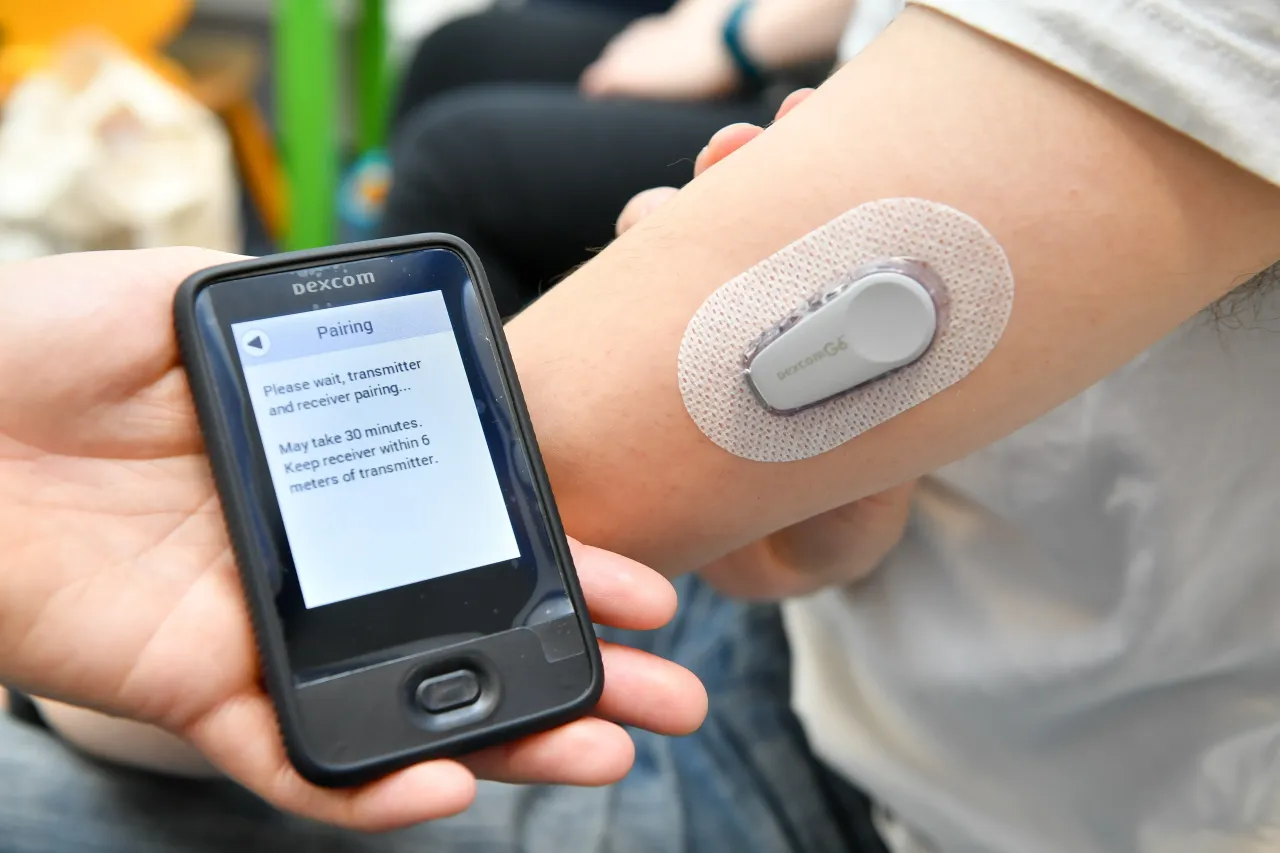 A Dexcom G6 Continuous Glucose Monitoring (CGM) System, is fixed to a patient's arm in a medical clinic. (Photo by Ben Birchall/PA Images via Getty Images)