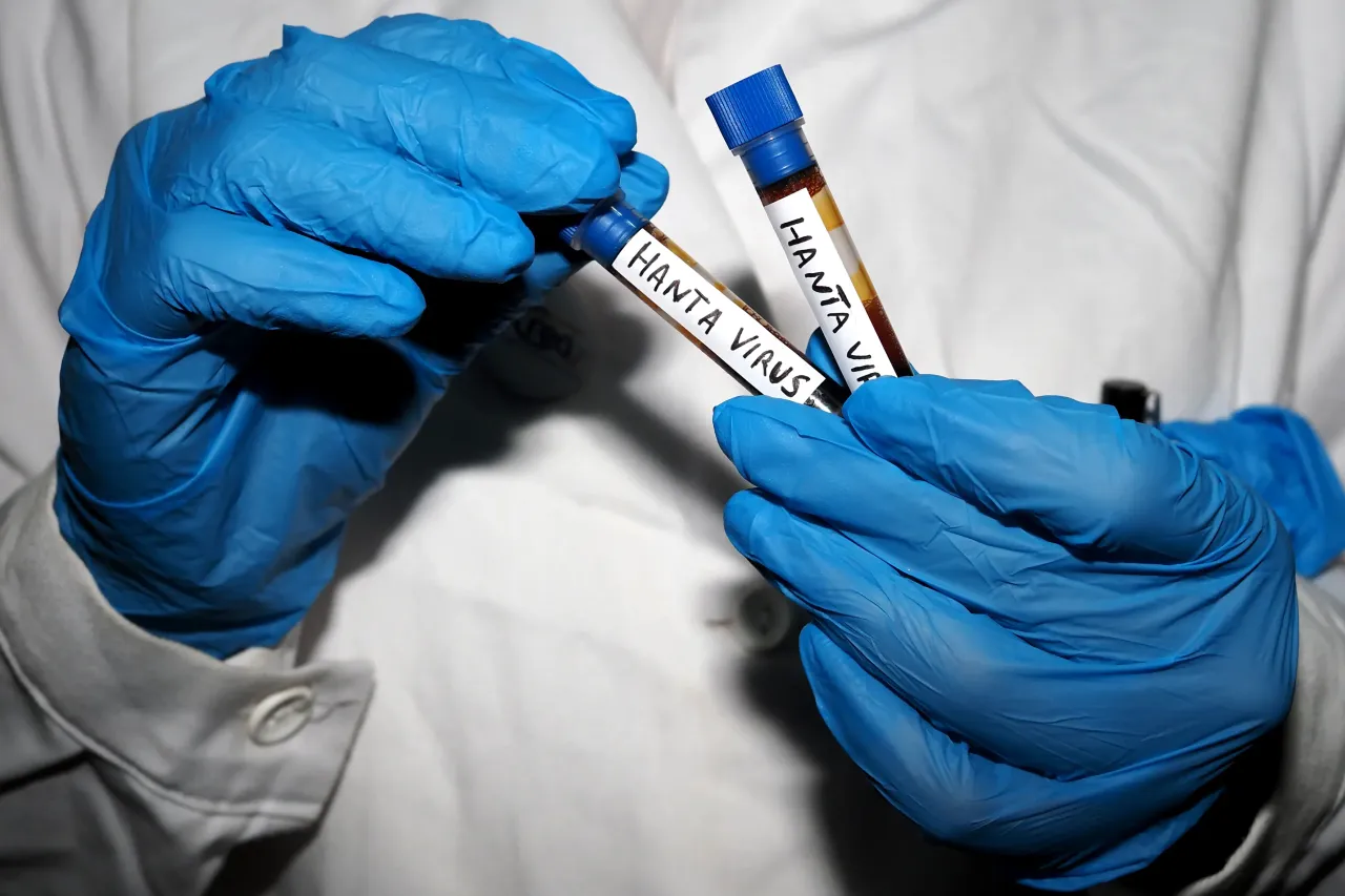 In this photo illustration, a laboratory test tubes containing blood to be analyzed for the Hantavirus "Orthohantavirus" outbreak, held by a nurse. (Photo Illustration by Vincenzo Izzo/LightRocket via Getty Images)