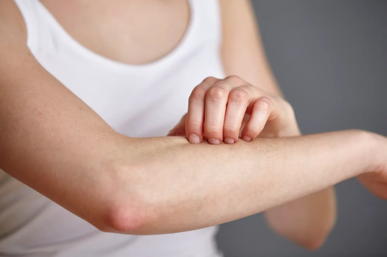 Jasper Therapeutics (JSPR) is investigating a compromised drug batch in its briquilimab skin allergy trial/ Photo credit: Getty Images